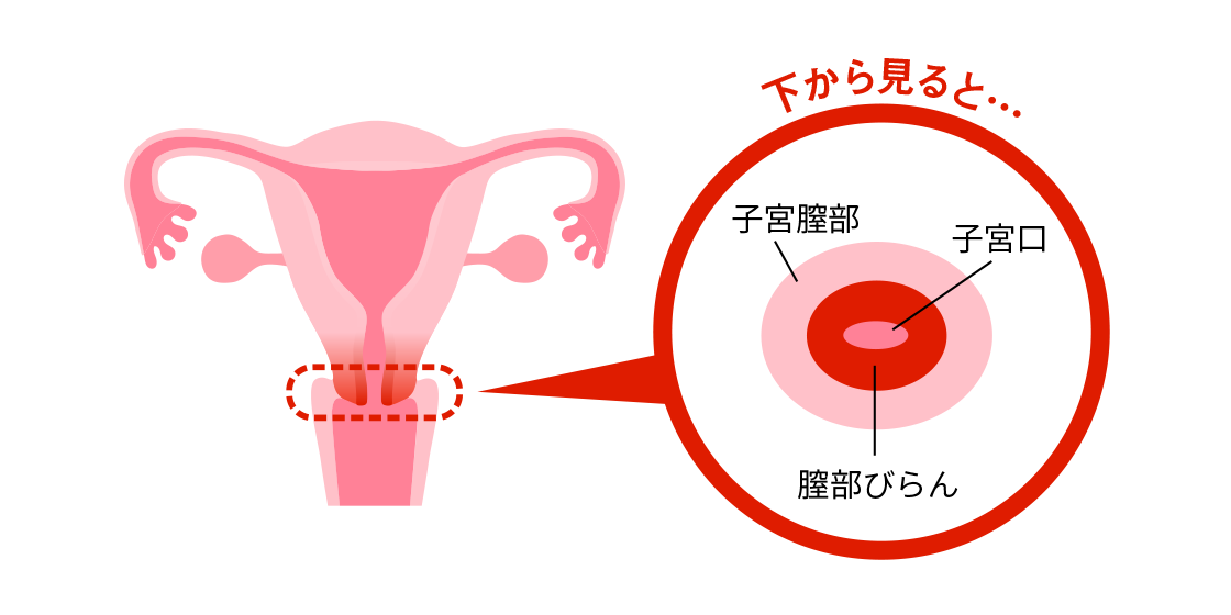 茶色 不正 出血